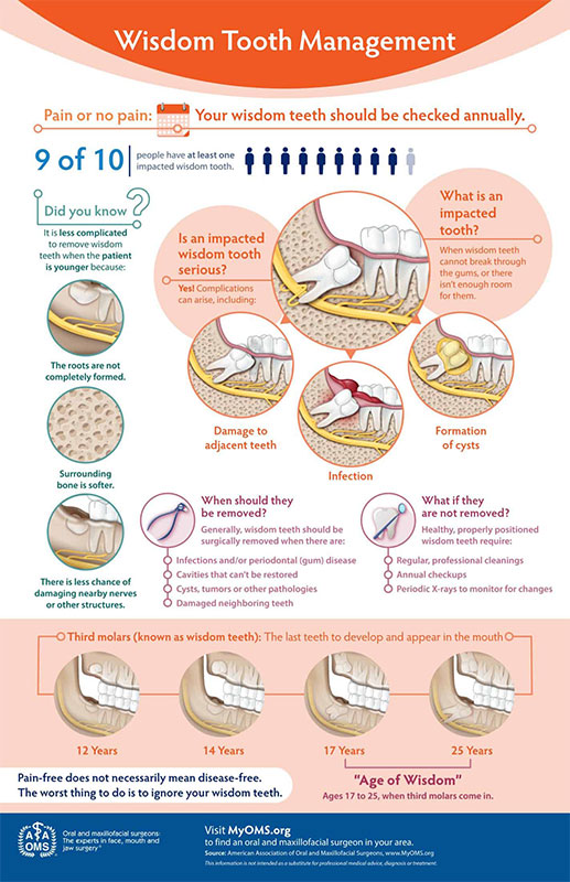wisdom teeth management infographic